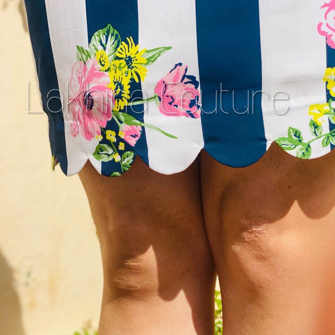 White & Blue Stripes Floral Dress